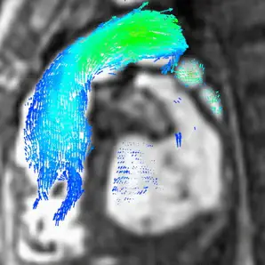 Quantitative cardiac MRI parametric map used in core lab image analysis