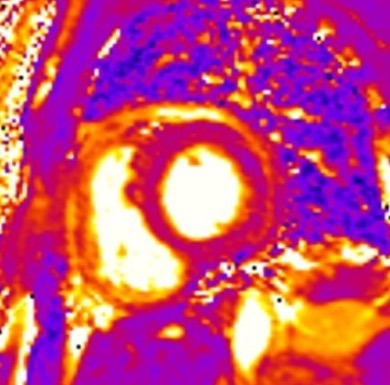 Cardiac CT reconstruction